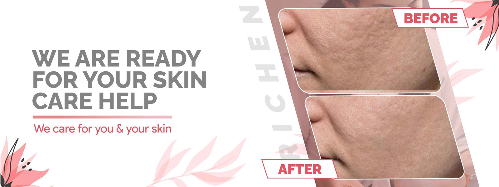 Best services by richen skin 